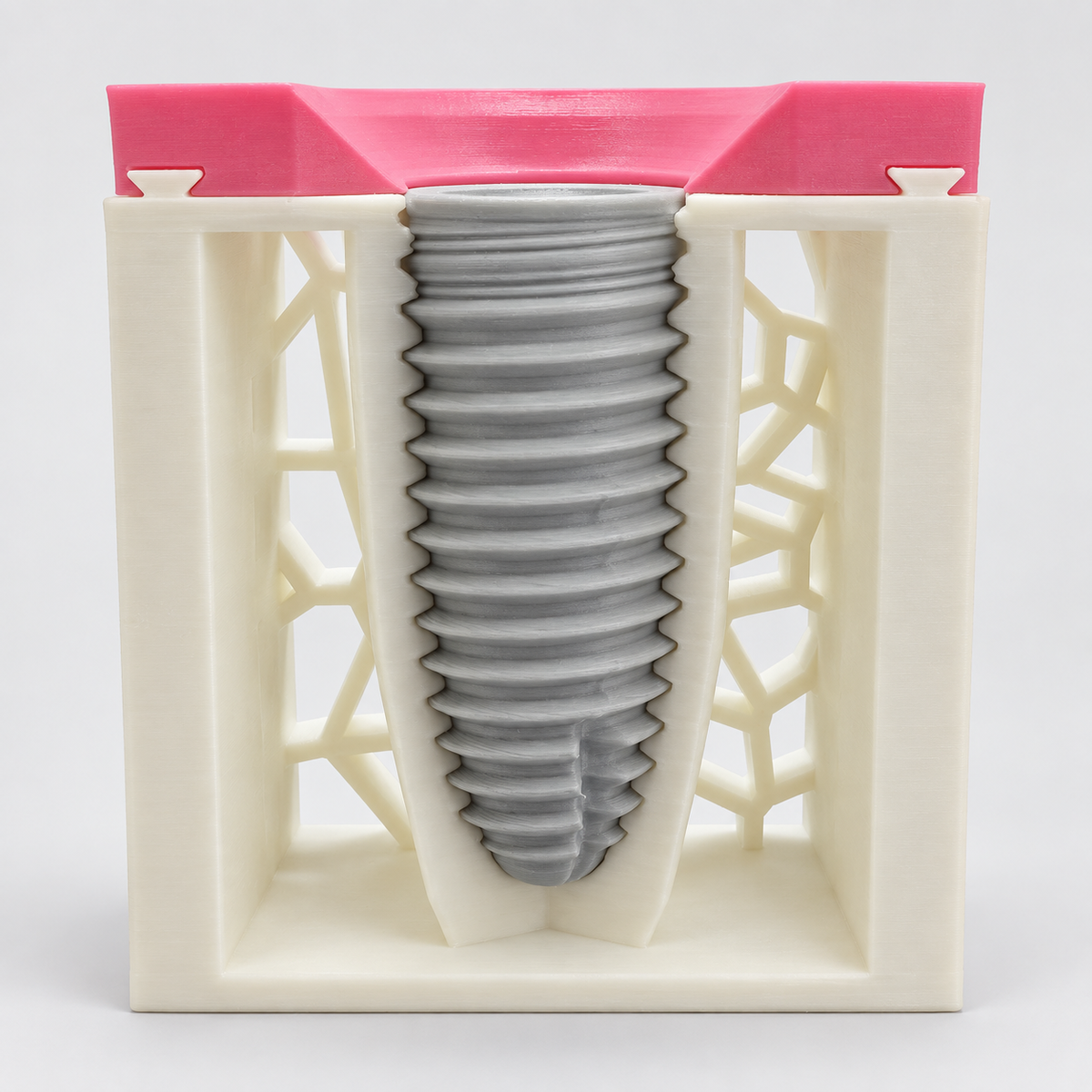 Dimensions Implant Teaching Model — صورة حقيقية معزولة توضح الزرعة والعظم واللثة بدون التاج